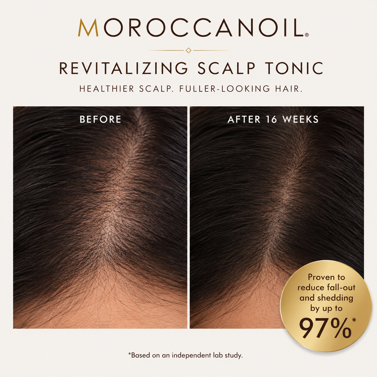 Moroccanoil Revitalizing Scalp Tonic before and after results showing reduced fall-out and shedding after 16 weeks.