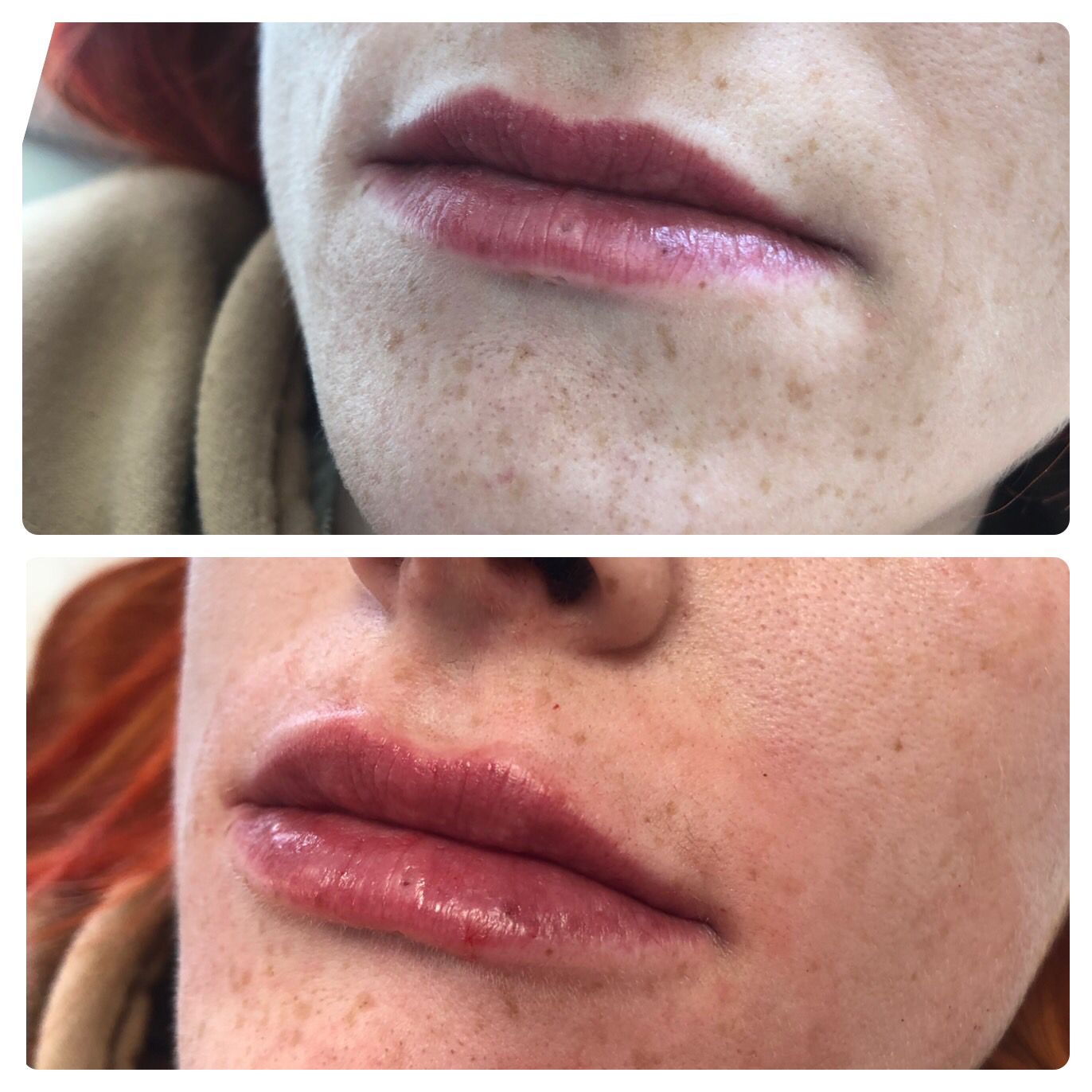 Nicola Welford -   Aesthetician