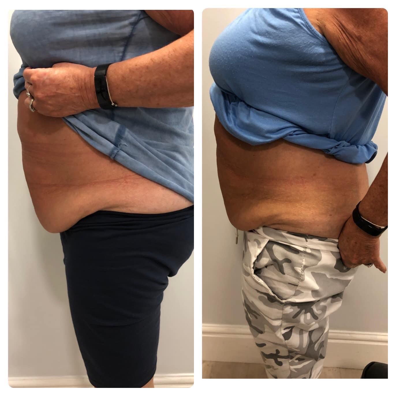 Nicola Welford - Cosmetologist