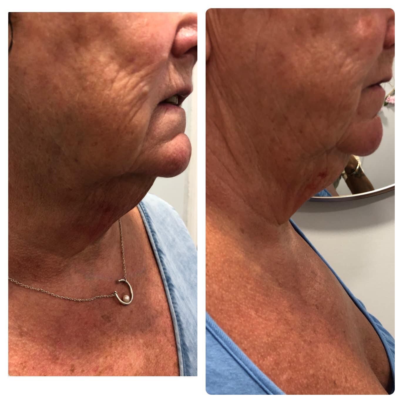 Nicola Welford -   Aesthetician